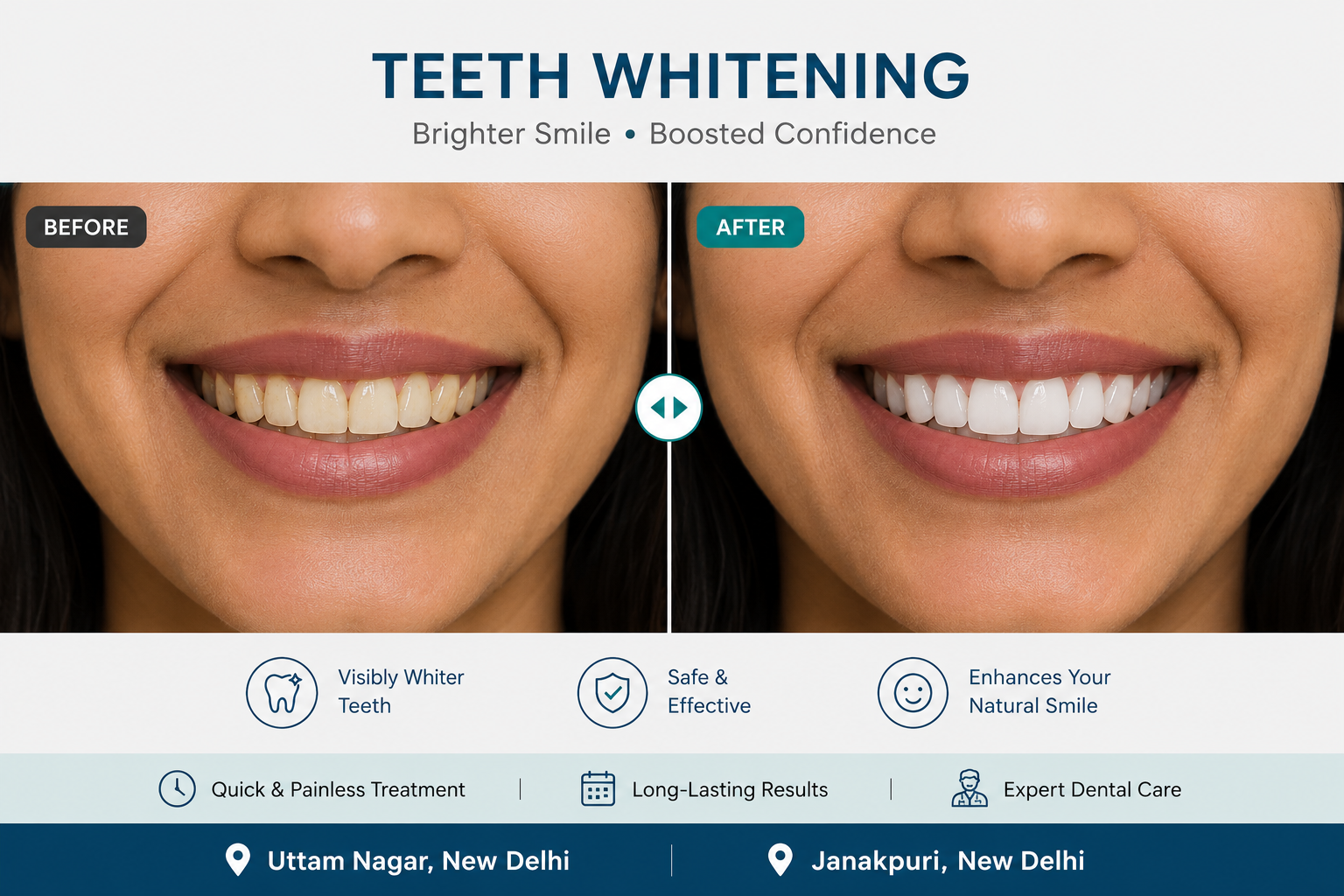 Professional teeth whitening at Sharanya Dental and Implant Care, Uttam Nagar, West Delhi