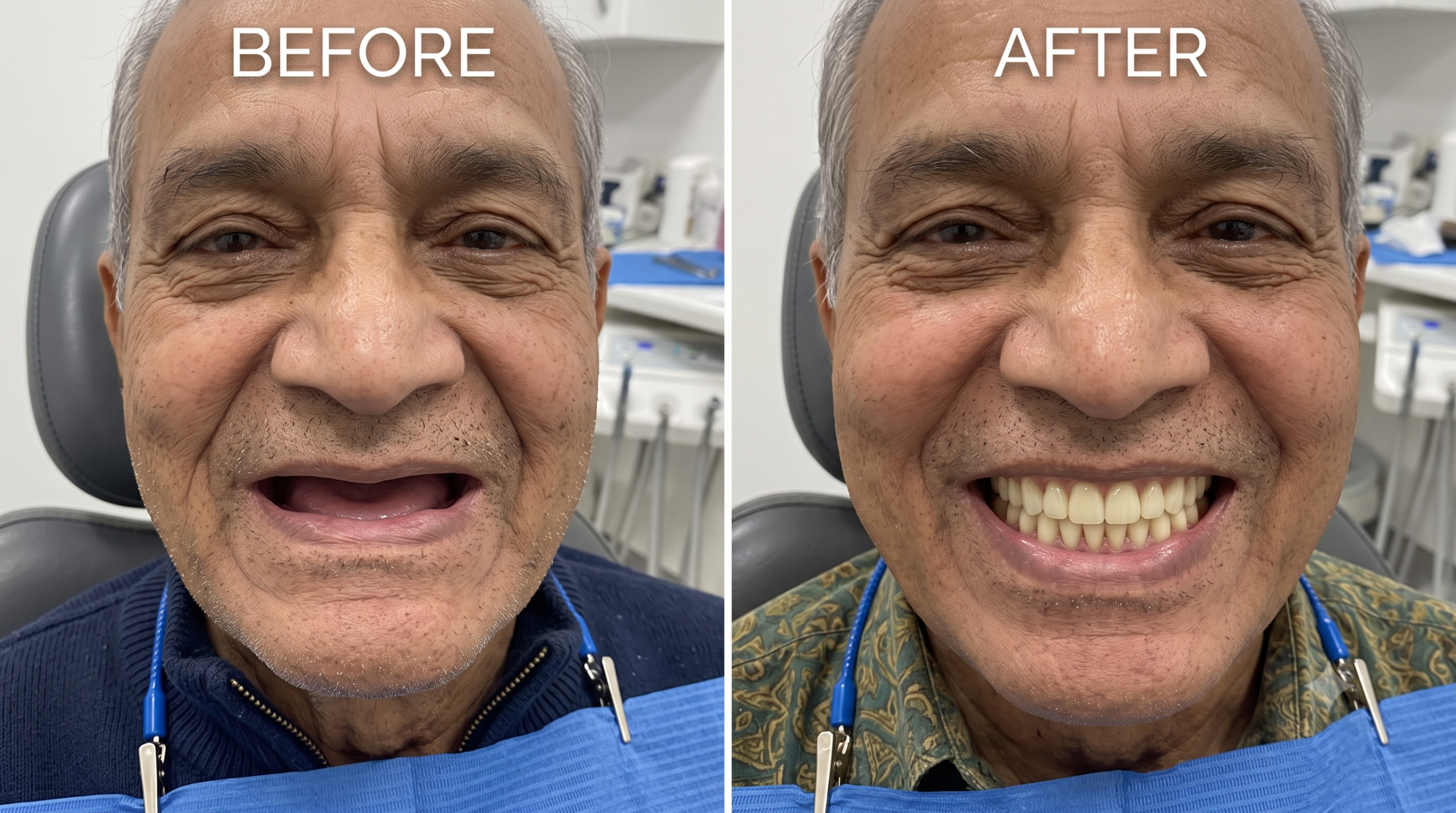 A complete denture case, before and after